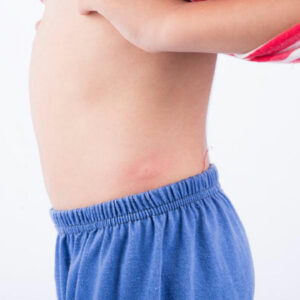 10 common types of skin rashes you should be aware of