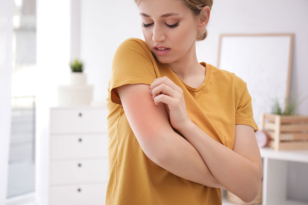 Allergies – Stages and prevention