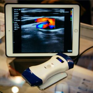 Portable ultrasound machines – Types and top choices