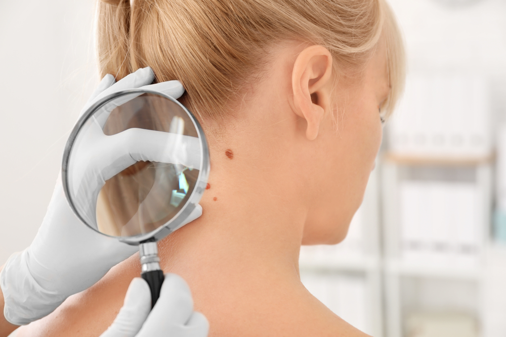 Worried About Skin Cancer Here’s What To Know