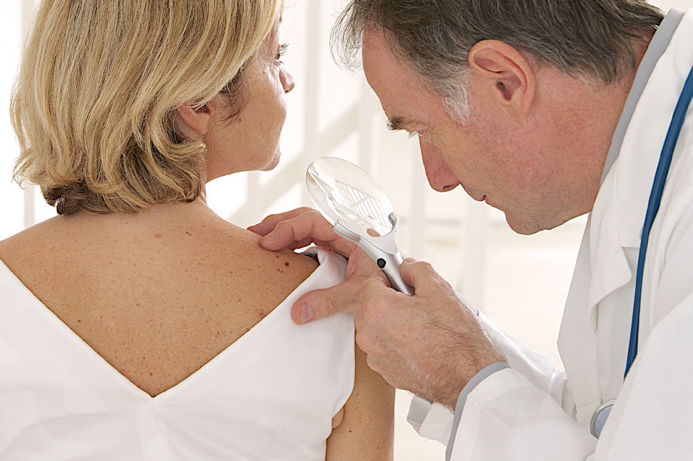 Perioral Dermatitis – Signs, Causes, Diagnosis, and Management