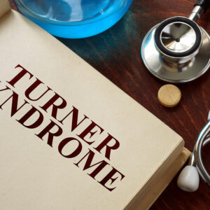 Turner Syndrome – Causes, Symptoms, and Management